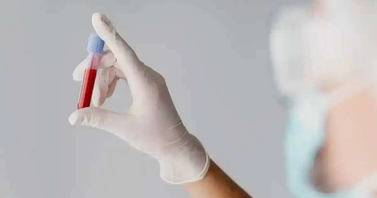 АИТВ туралы ашық сөйлесейік – эпидемиолог