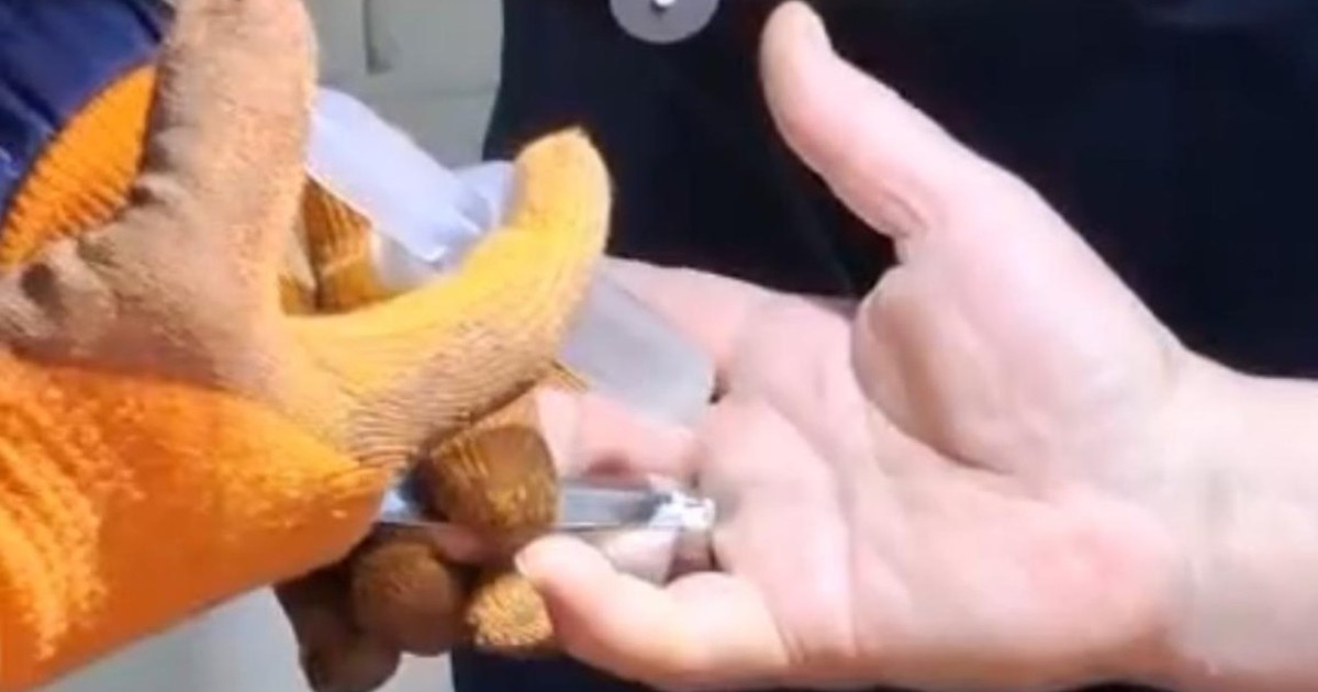 Қызылордада құтқарушылар ер адамның саусағынан сақинаны шығарып алып берді