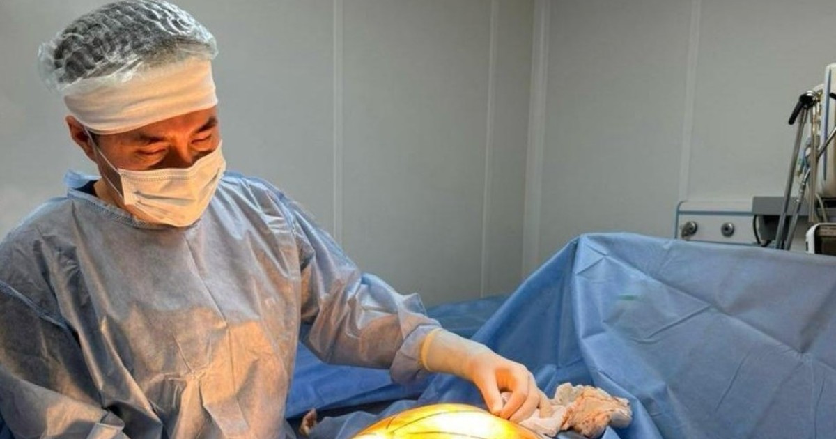 Елімізде дәрігерлер науқастың денесінен 25 келілік ісікті алып тастады