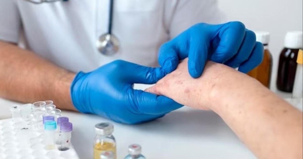 Қазақстанда қызылшамен сырқаттанушылар саны азайды