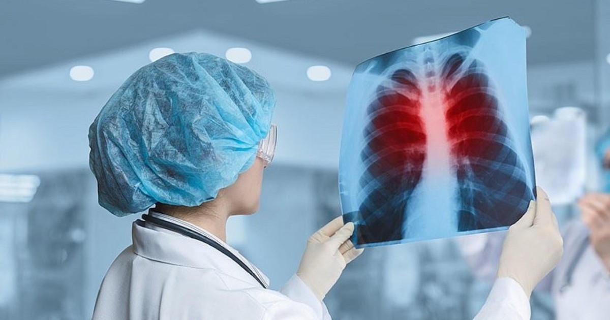 Туберкулез туралы әр адам білуі тиіс маңызды ақпарат