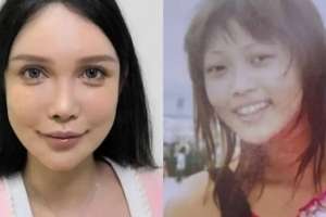 «100 рет пышаққа түстім. Тоқтайтын ойым да жоқ»: Қытайлық әйел сұлу болу үшін 10 жыл бойы операция жасатқан