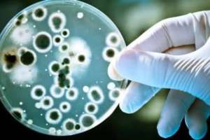 Жыл  басынан бері елімізде 17 адам сібір жарасын жұқтырған