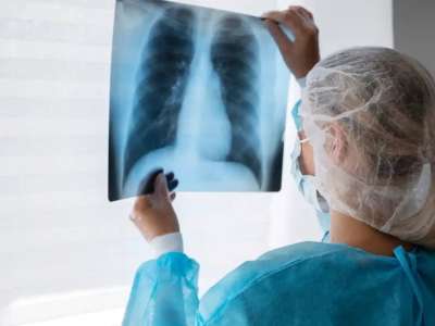 Елімізде туберкулезбен сырқаттанушылық 13,9 пайызға төмендеді