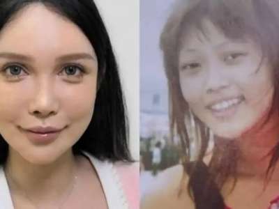 «100 рет пышаққа түстім. Тоқтайтын ойым да жоқ»: Қытайлық әйел сұлу болу үшін 10 жыл бойы операция жасатқан