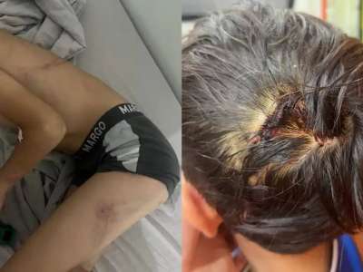 Балқашта соққыға жығылған 8 жасар баланың ісі бойынша тың деректер жарияланды