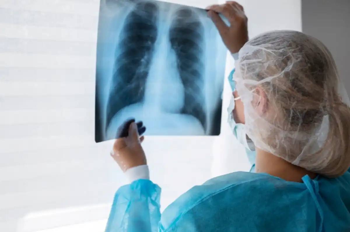 АИТВ жұқтырған адамдарда туберкулездің даму қаупі ерекше – астаналық дәрігер