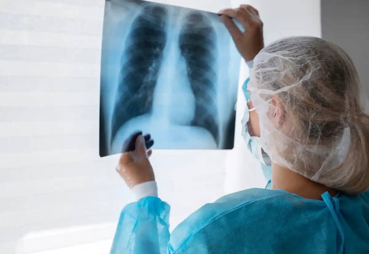 Елімізде туберкулезбен сырқаттанушылық 13,9 пайызға төмендеді