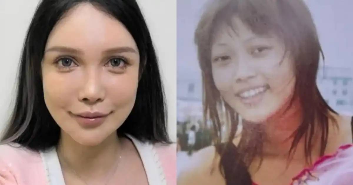 «100 рет пышаққа түстім. Тоқтайтын ойым да жоқ»: Қытайлық әйел сұлу болу үшін 10 жыл бойы операция жасатқан