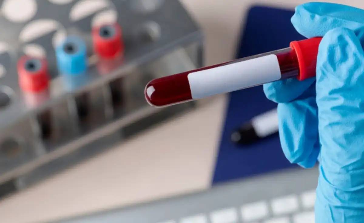 АИТВ кезіндегі стигма мен кемсітушілікке жол жоқ