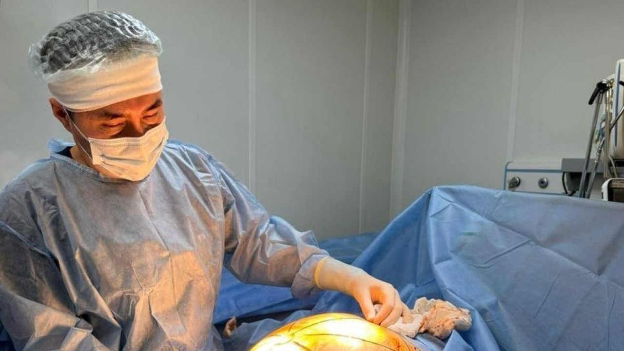 Елімізде дәрігерлер науқастың денесінен 25 келілік ісікті алып тастады