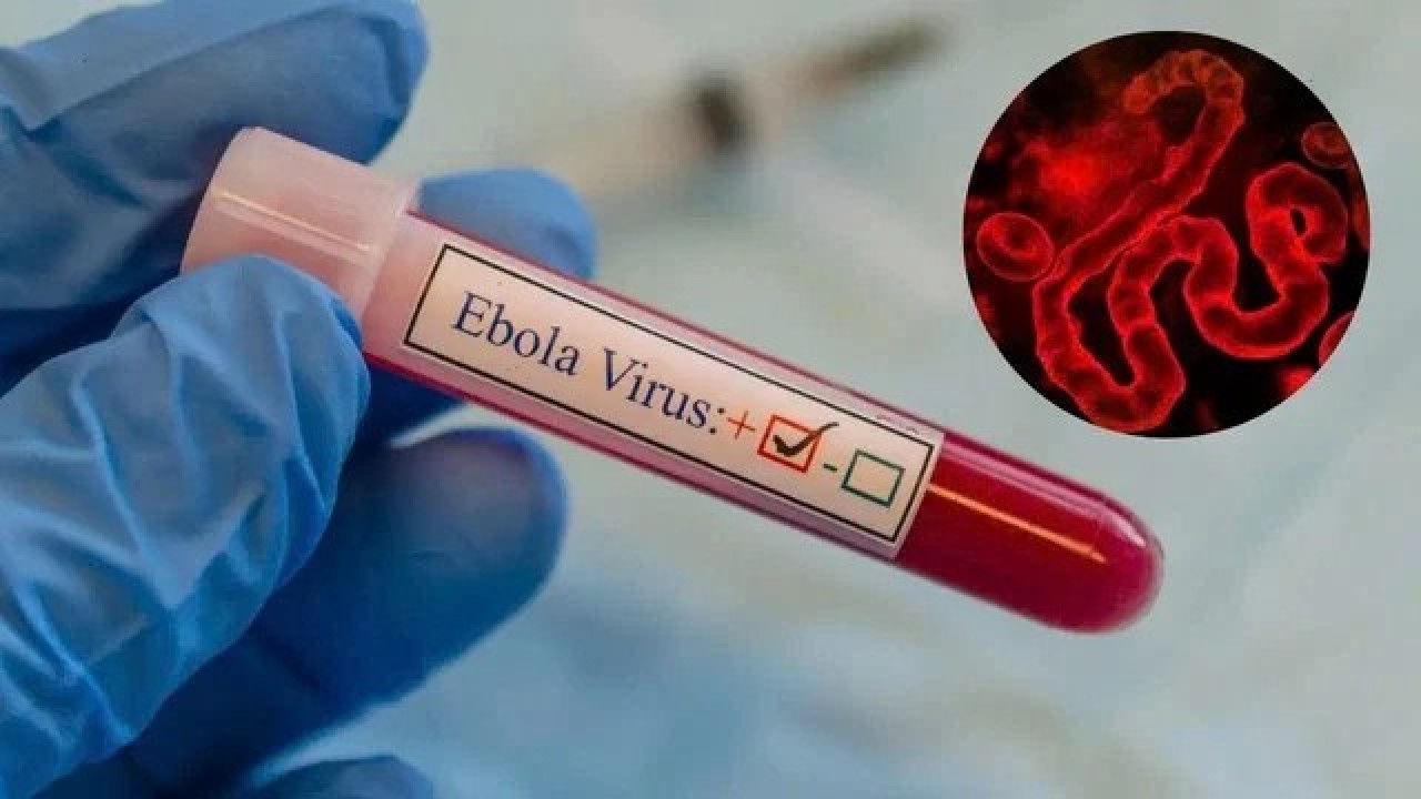 Денсаулық сақтау министрлігі эбола вирусына байланысты ескерту жасады